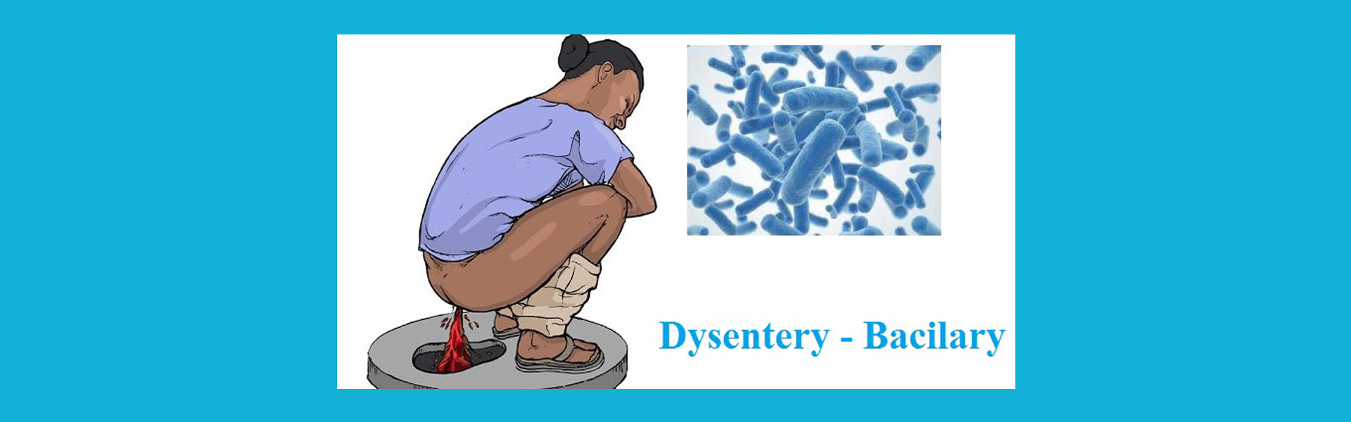 আমাশয় - রক্ত আমাশয়, Dysentry - Bacilary, পাকস্থলী, Stomach, পায়খানা, মল, আম