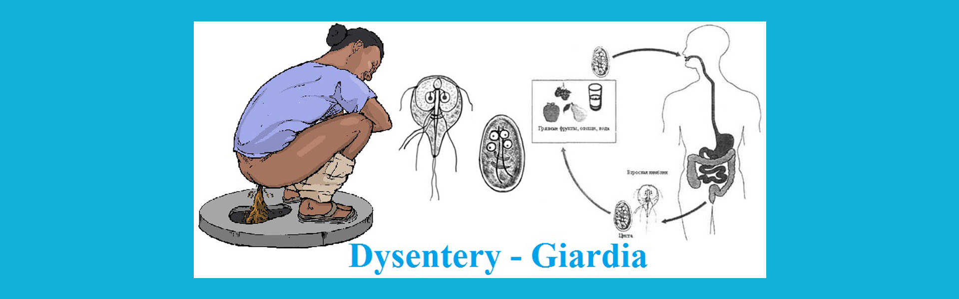 আমাশয় - জিয়ারডিয়াল, Dysentry - Giardial, পাকস্থলী, Stomach, পায়খানা, মল, আম