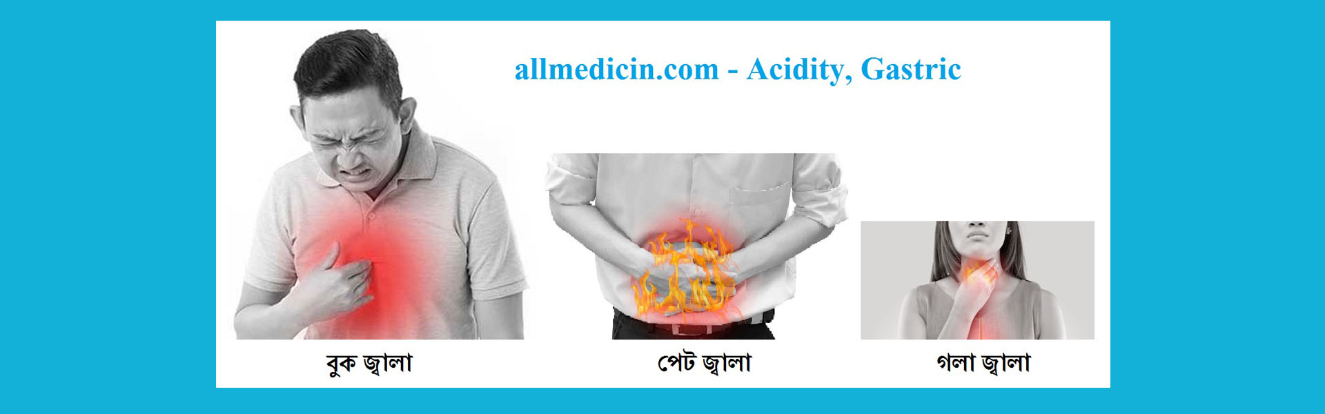 অম্ল, এসিডিটি, গ্যাস্ট্রিক, Acidity, Gastric, পাকস্থলী, Stomach, বুক জ্বালা, পেট জ্বালা, গলা জ্বালা, পেট ব্যথা,
