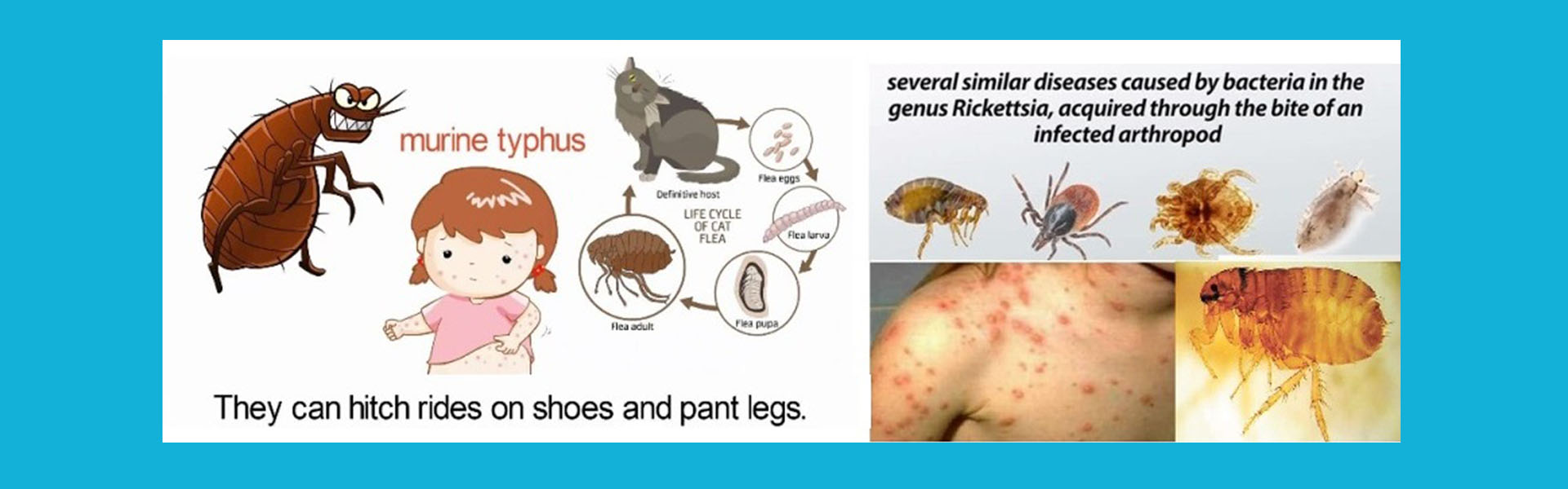 জ্বর, টাইফাস ফিভার, Fever, Typhus Fever